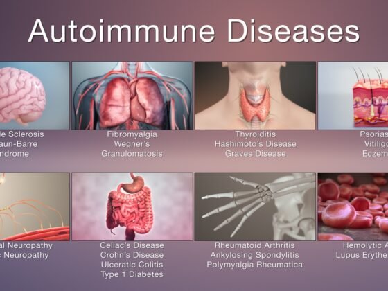 Autoimmune Disorders + Cannabis